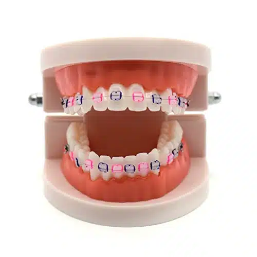 Angzhili Piece Dental Demonstration Orthodontic Model with Metal Wires and Bracket (Ceramic bracket)