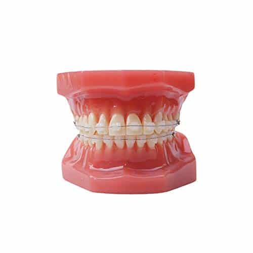 Dental Typodont With Ceramic Brackets Orthodontic Braces Teeth Model,pcs Teeth Ceramic Braces Model For Teaching Practice