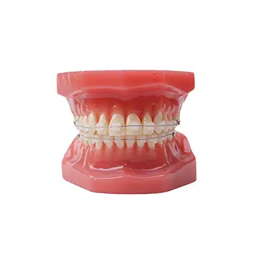 Dental Typodont With Ceramic Brackets Orthodontic Braces Teeth Model,pcs Teeth Ceramic Braces Model For Teaching Practice